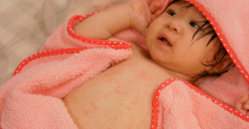 宝宝感染性发烧如何处理,3周岁孩子发烧39.5度其他症状没有