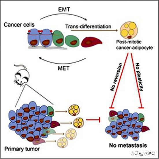 瑞士发现癌细胞可转化脂肪乳腺癌治疗有丰胸效果