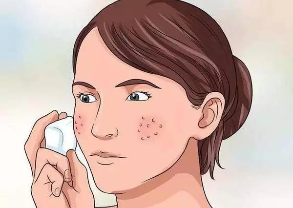 刷酸真的烂脸吗,刷酸烂脸后还继续刷吗