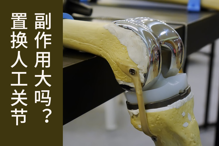 老年人关节病想置换人工关节，又担心副作用，该怎么办？