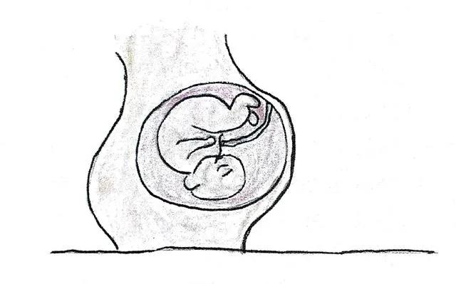 光动力治疗三个必要条件,光动力治疗标准操作过程