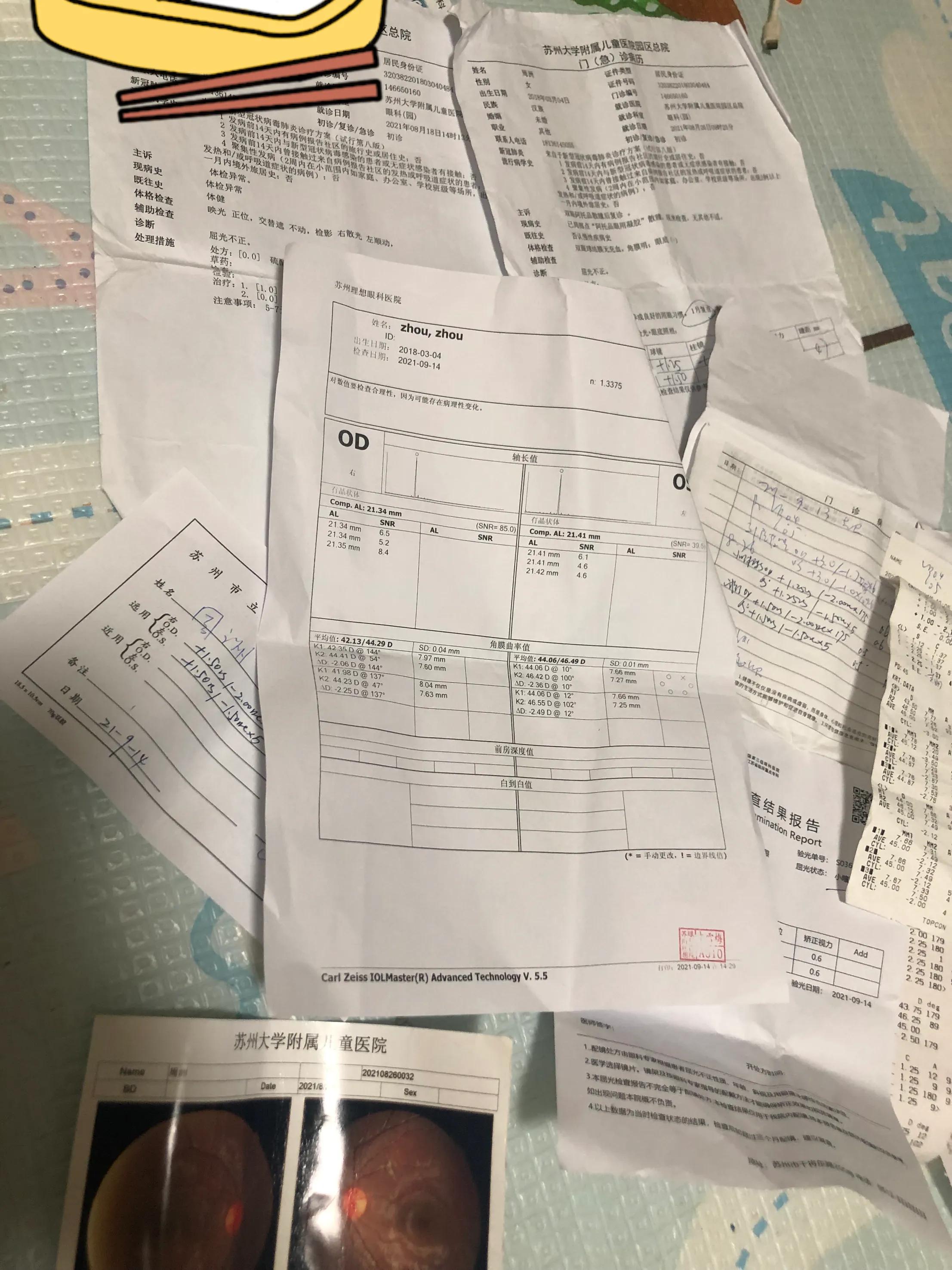 幼儿园体检散光3.0严重吗,3岁体检散光