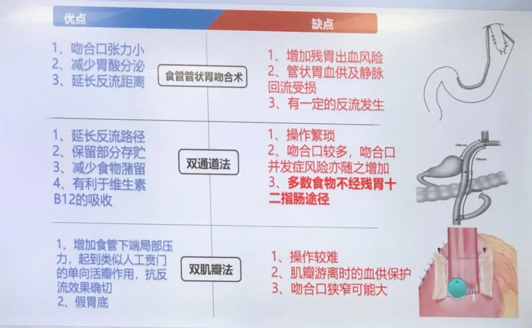 把胃切了怎么消化,把胃都切了会怎么样