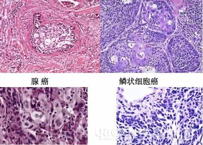 外科切下来肉该怎么处理,医院里手术切下来的东西哪里去了