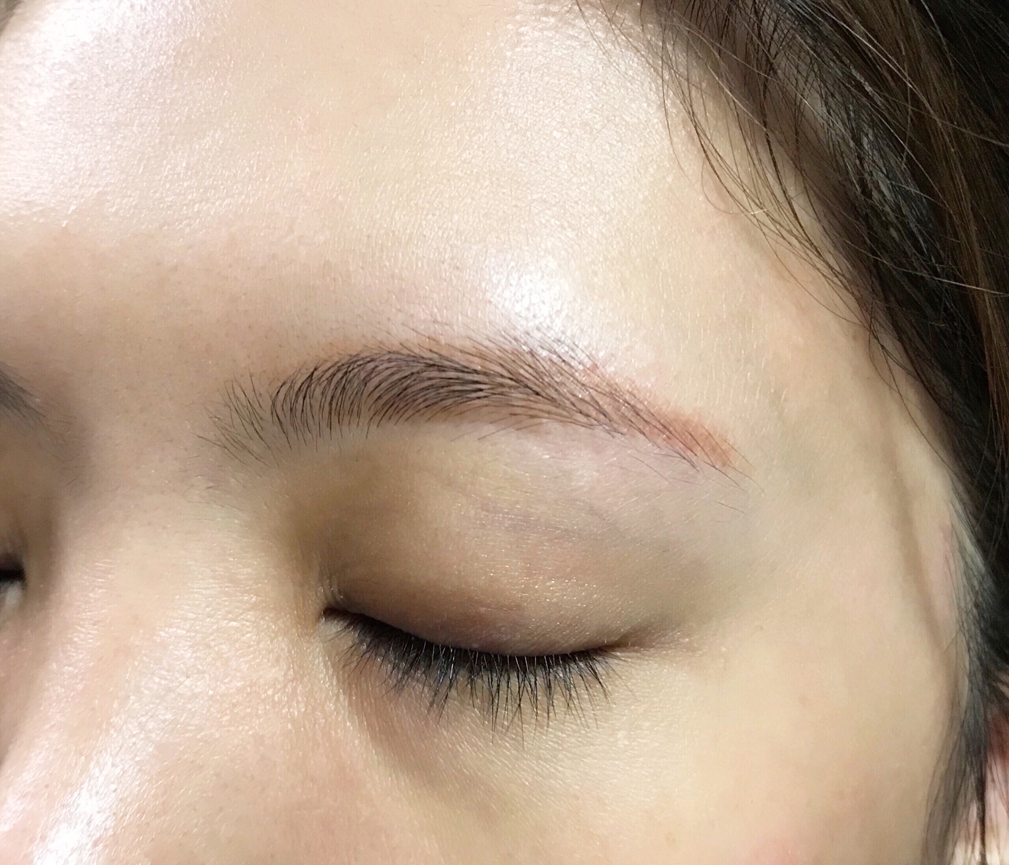 激光洗红眉的操作方法视频,红眉能激光吗