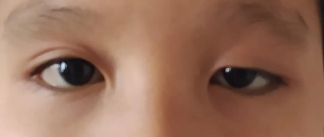 3岁小孩平时爱挑眉、耸肩，医生却说不是坏习惯？