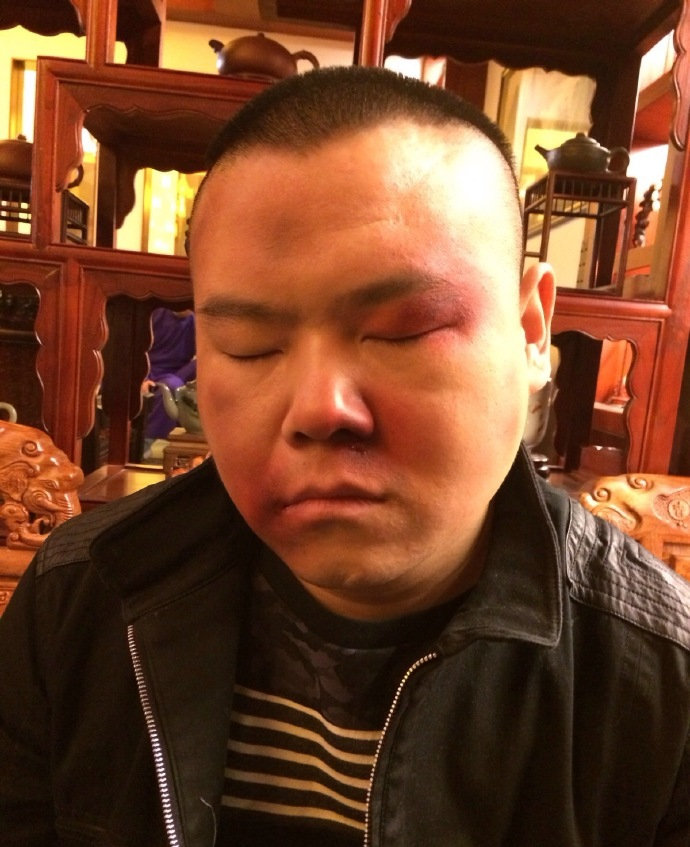 小伙子能治痔疮的搞笑段子,小伙子你能治痔疮吗笑话