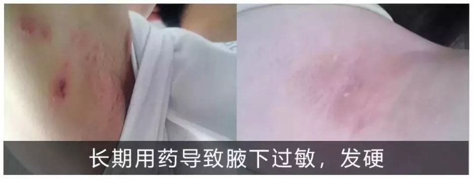 药物治疗和做手术哪个好,药物治疗和手术治疗