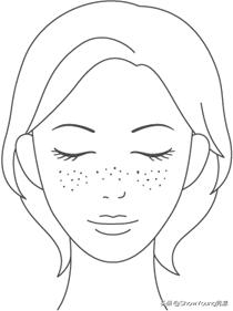 要肌肤像剥了壳的鸡蛋？你对斑了解多少？