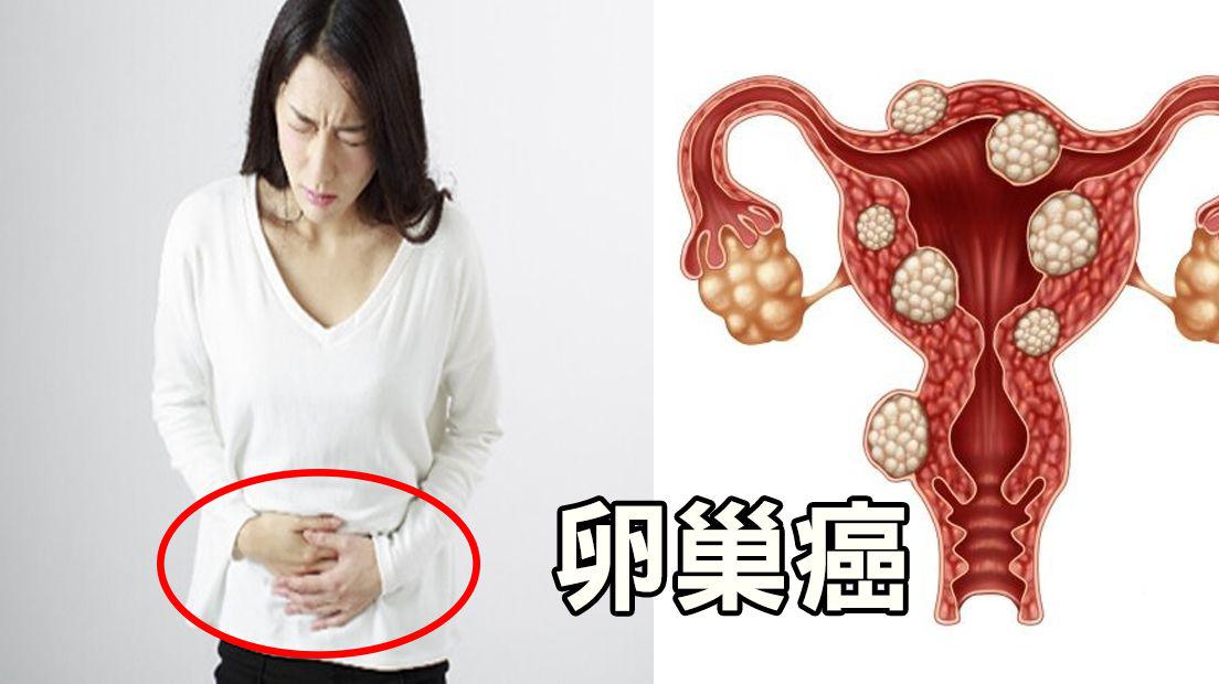 女性盆腔肿瘤mri诊断思路,盆腔肿瘤先手术还是先穿刺活检