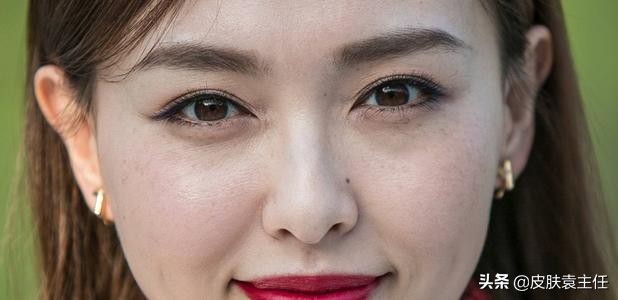 遮瑕遮不住雀斑怎么办,什么样的遮瑕可以遮掉雀斑