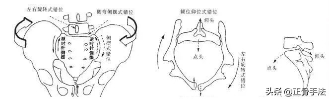 骶尾椎错位正骨手法,骶椎错位怎么复位