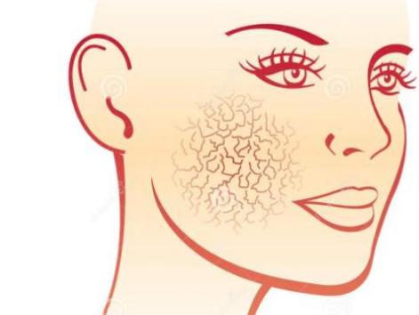 如何根据不同肤质挑选护肤品呢,角质层薄混合肤质用什么护肤品