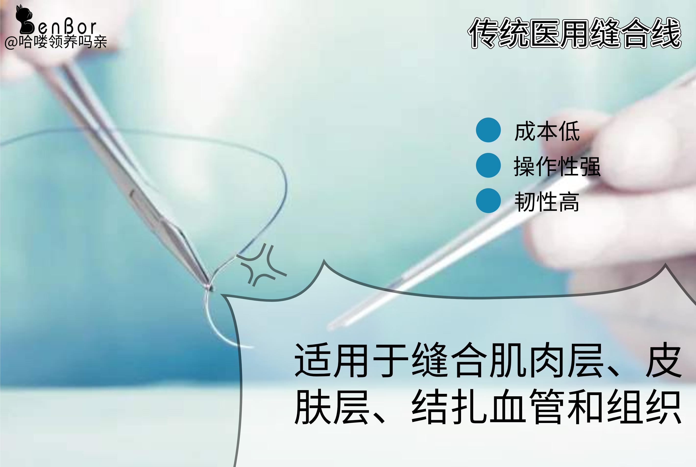 免拆线到底是拆还是不拆好,免拆线和普通线的利弊