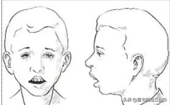 孩子睡觉打呼噜14岁,小朋友晚上睡觉打呼噜怎么治好