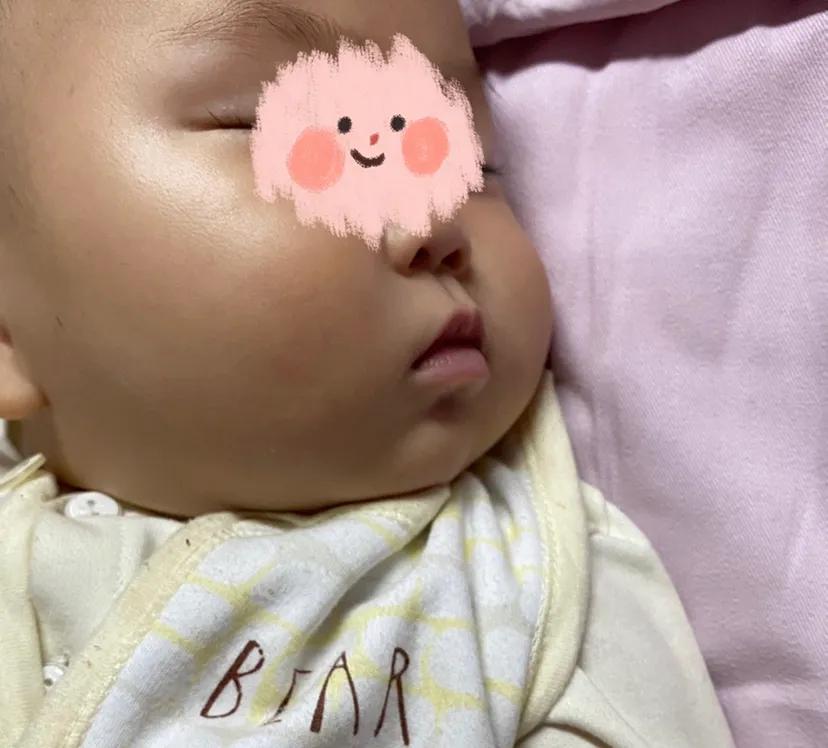 宝宝严重贫血是需要住院吗,宝宝贫血妈妈需要注意什么