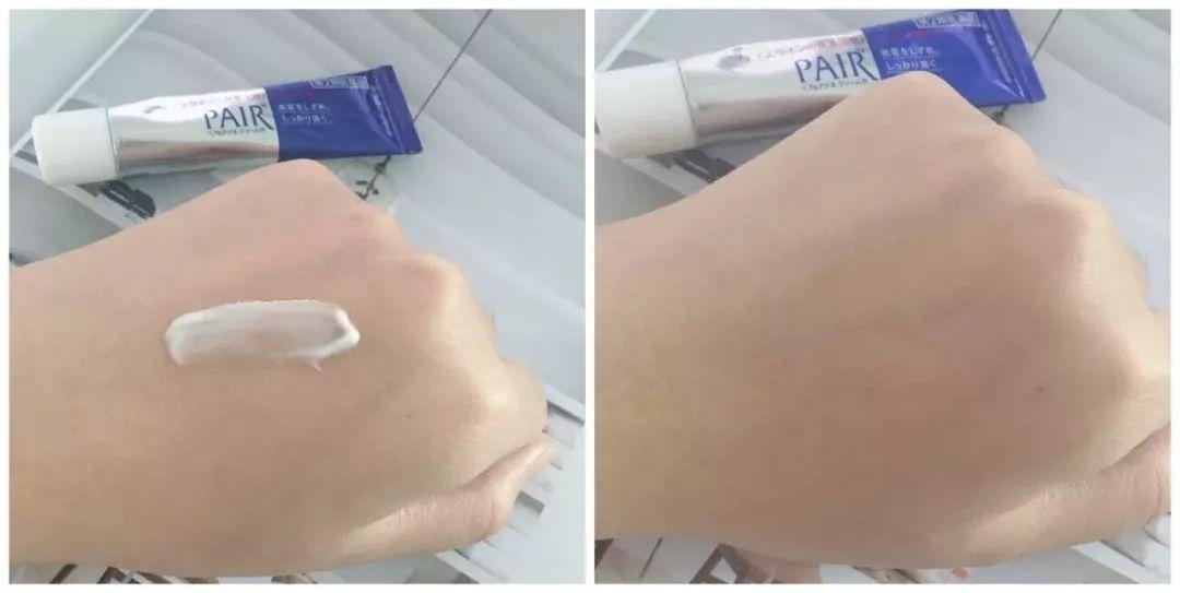 超好用的祛痘膏便宜,有没有好用的祛痘膏推荐女孩子