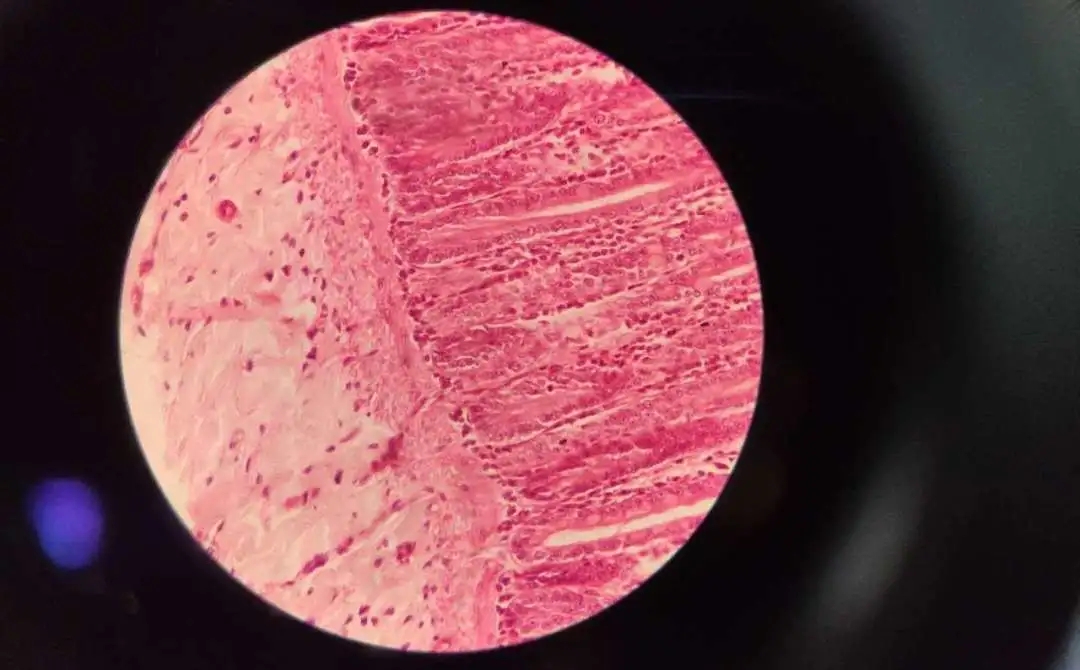 医学生学习打卡做题,医学生学习成果检验视频