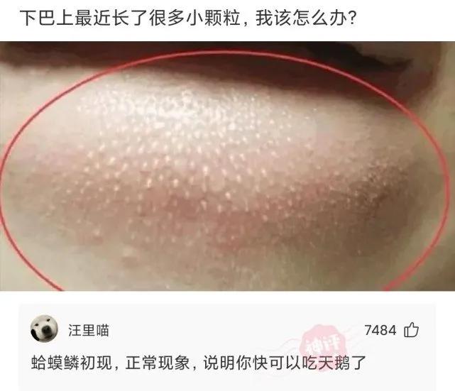 搞笑下巴突出,嘴下巴长了好多小颗粒是什么原因
