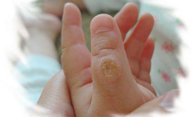 如何让6岁多的孩子戒掉吃手指,3岁小孩吃手指怎么戒掉