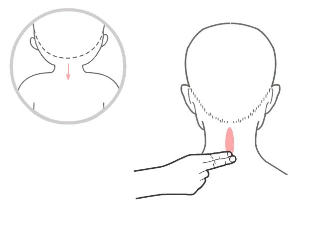 孩子得急性肠胃炎需要输液吗,小孩得肠胃炎很难好吗