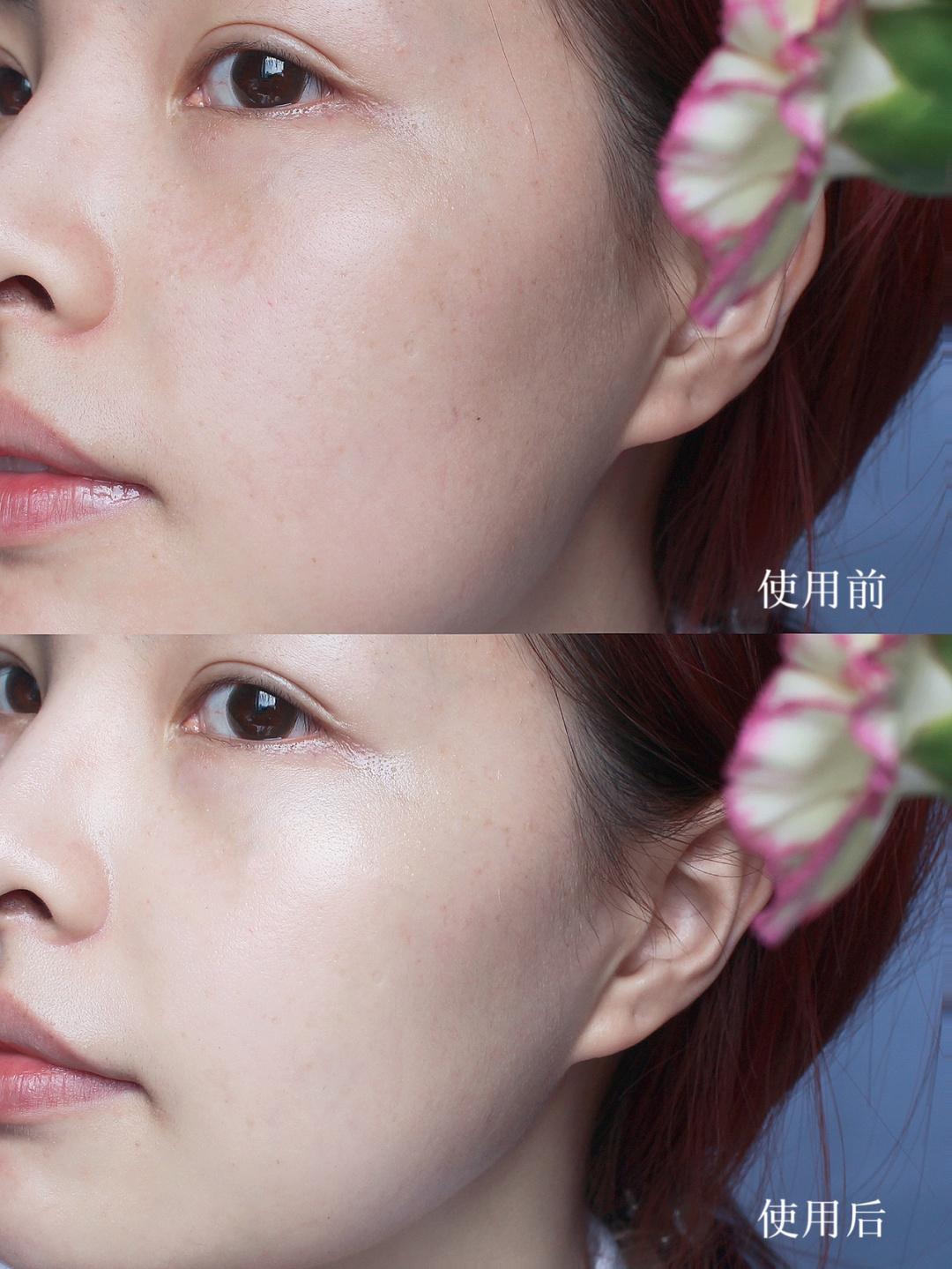 换季必备补水修护宝藏面霜,firstaidbeauty急救面霜敏感肌