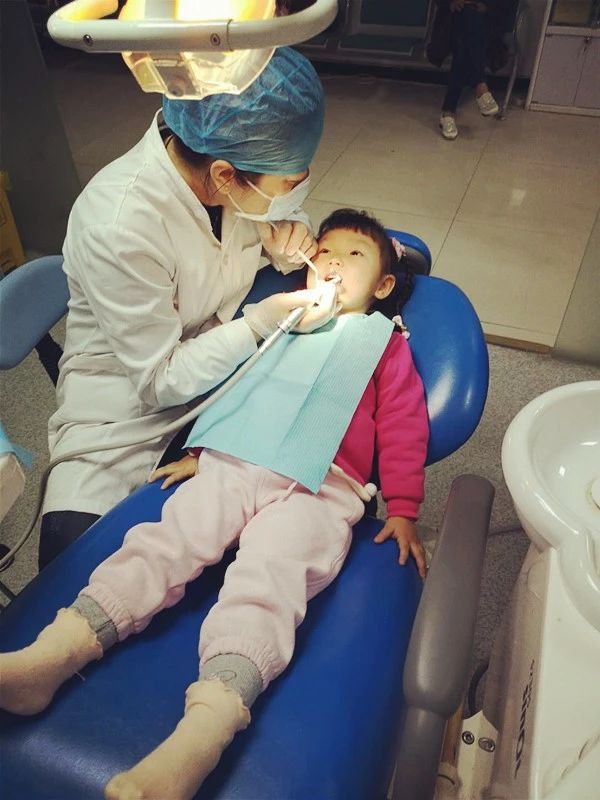 窝沟封闭适合几岁孩子做,在家给娃做窝沟封闭