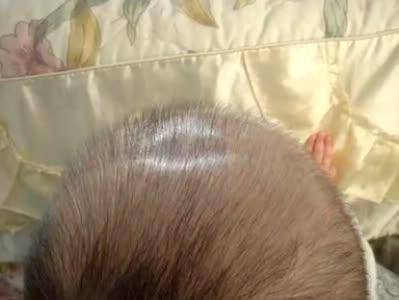 宝宝的囟门能碰吗,新生儿的囟门不小心用手按了