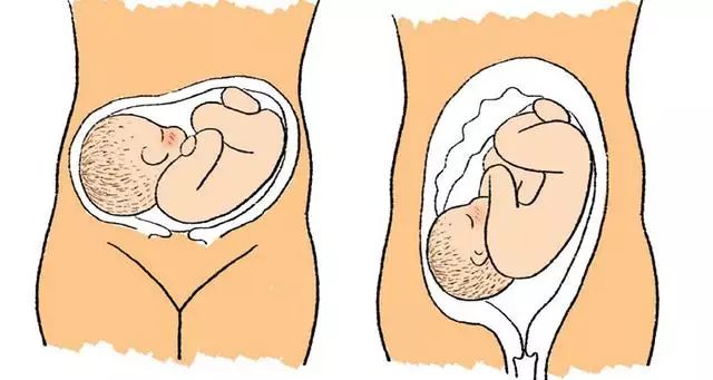 胎儿会打嗝但是胎动少,胎儿也会打嗝