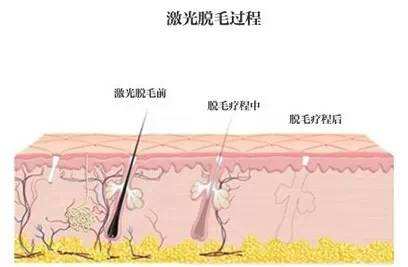 打美白针有什么副作用?应该如何安全美白?