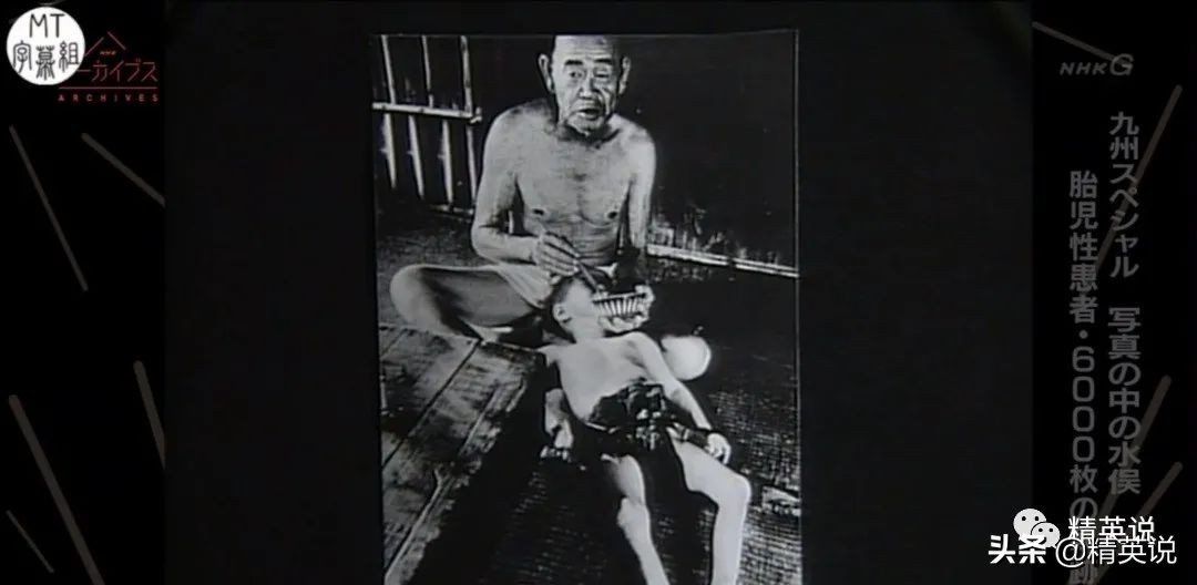 60多年前日本万人中毒成世界公害！如今福岛百万吨核废水入海…