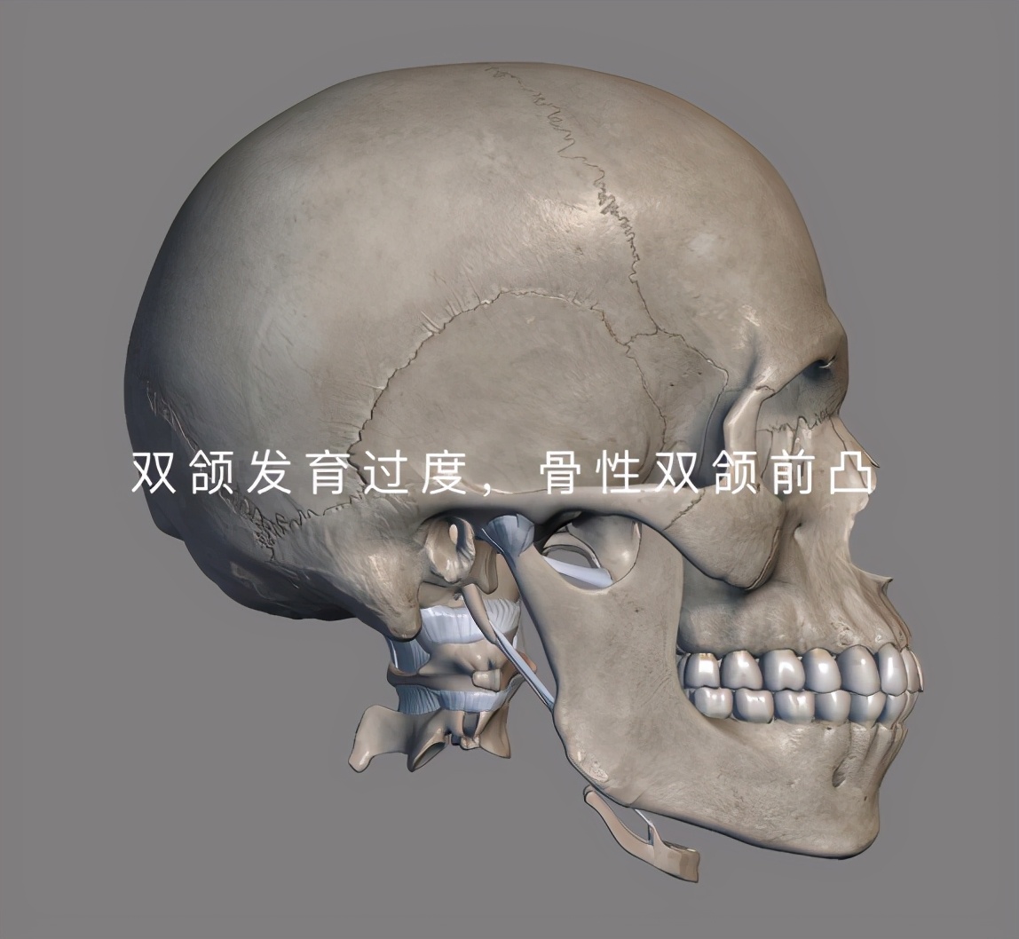 颌骨大小不一靠牙齿矫正能改善吗,牙齿矫正能改善下颌骨发育不足吗