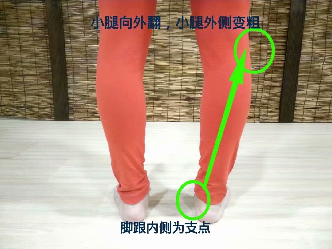 扁平足穿什么鞋都痛吗,扁平足穿什么鞋可以矫正