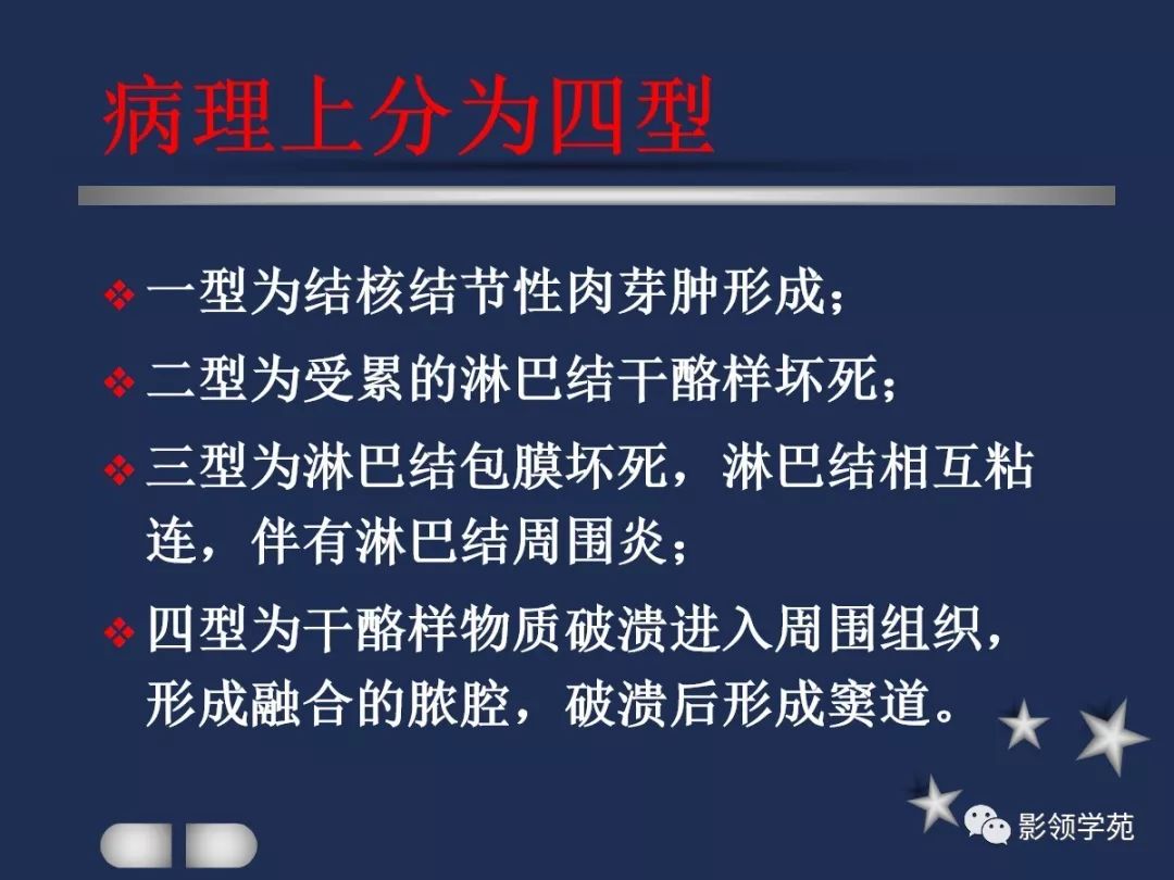 腮腺疾病影像学诊断,腮腺肿块影像诊断