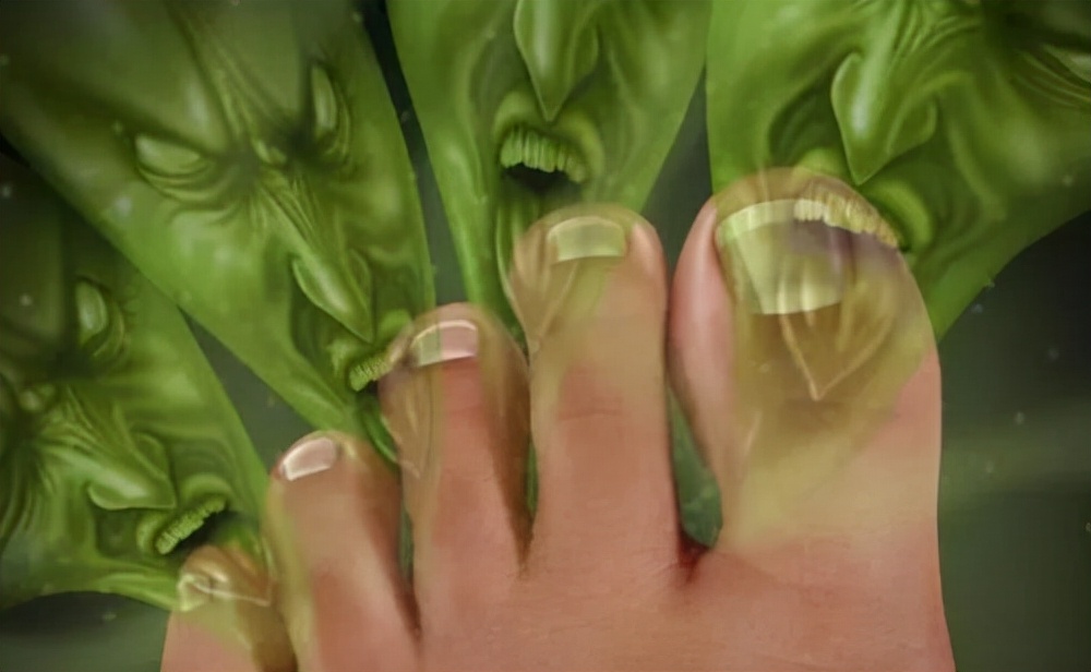 夏天脚臭脚痒怎么办最有效,夏天去除脚臭最简单的方法