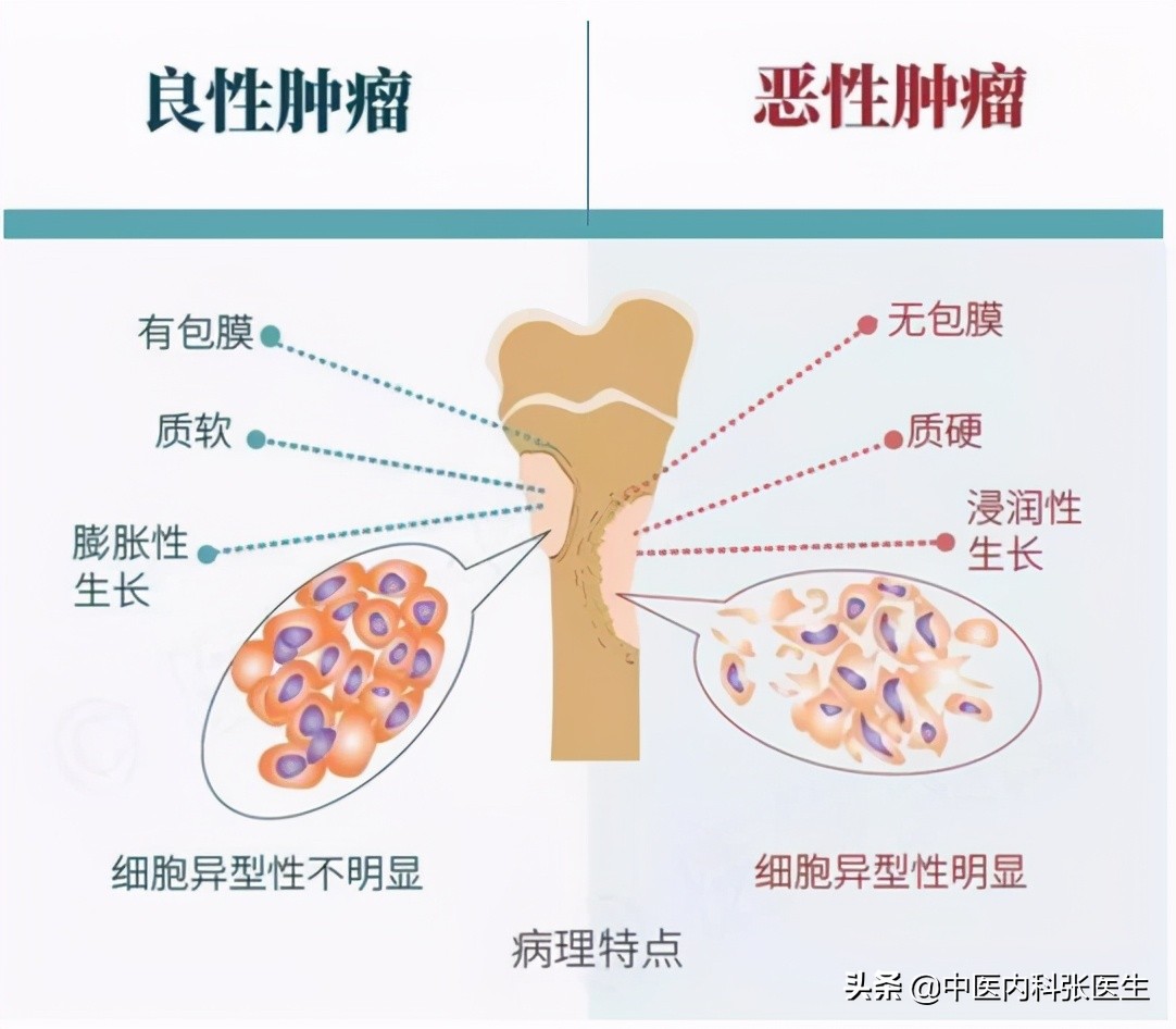 结节的真实案例,发现结节不以为意分享经验教训