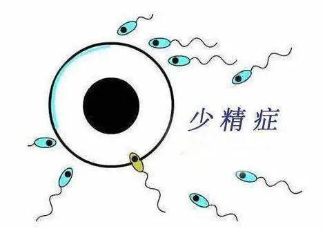 精子异常是怎么回事,精子异常是如何导致