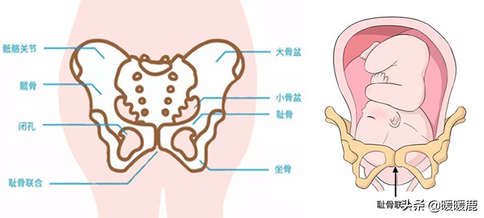 孕妇下身骨头隐隐作痛,孕妇耻骨痛是不是外阴的位置