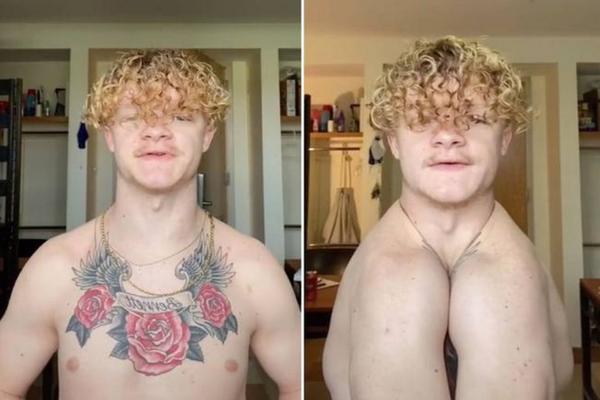 人如果没有肋骨会怎么样,人没有锁骨能活吗