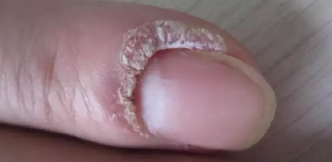 脸上长了像黑痣一样的东西,脸上长了像痘痘的东西是啥