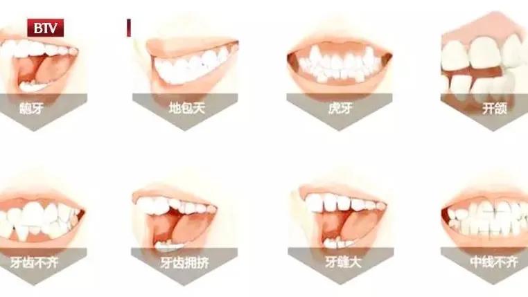 吃饭老塞牙缝怎么治疗,吃饭总塞牙你知道问题出在哪里吗