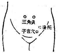 按摩调理痛经手法,中医按什么穴位缓解痛经