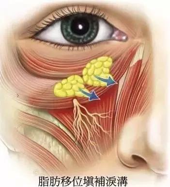 眼霜都是骗局吗视频,眼霜误区99%的人不知道