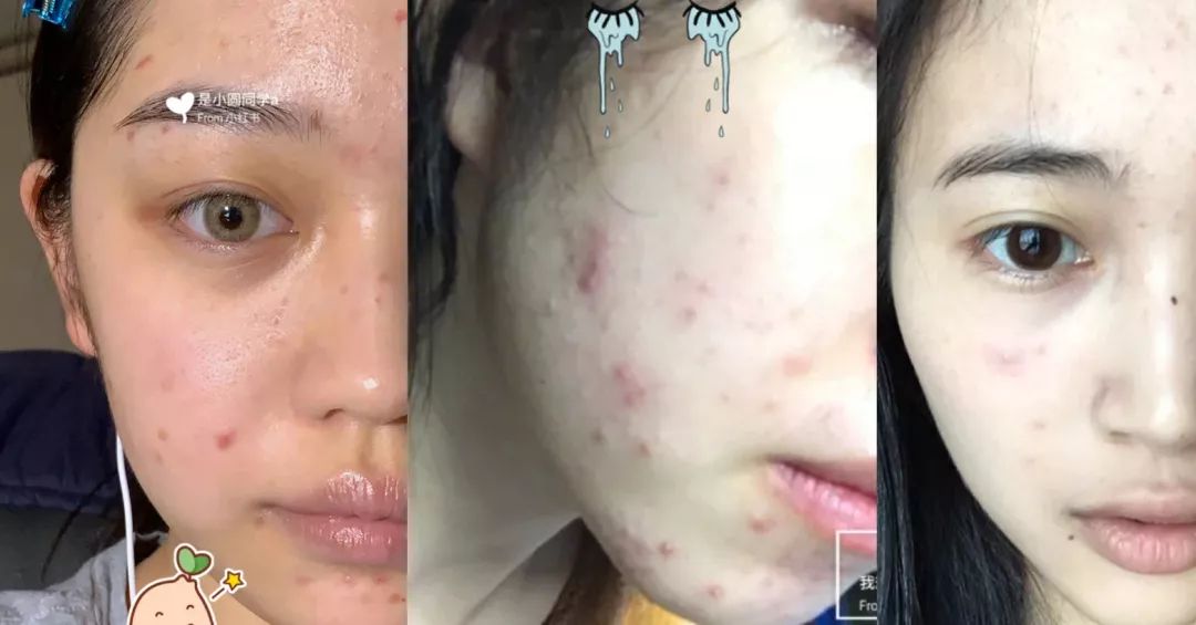 泰国teechda素颜霜,泰国素颜霜排行榜第一名遮瑕效果