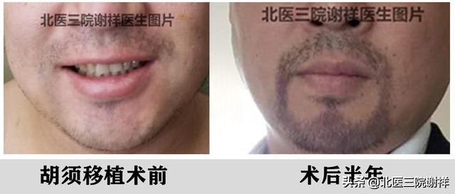 男性如何增加自己的魅力,男性提升魅力的捷径