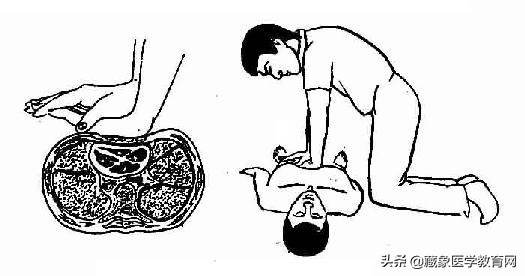 最全急救常识关键时刻能救命,掌握急救知识及时挽救生命