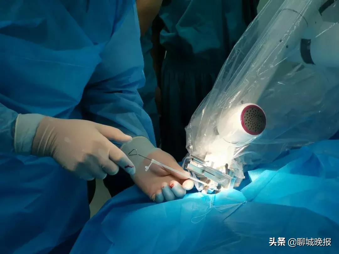 微创脑手术机器人,脑出血下肢智能康复机器人