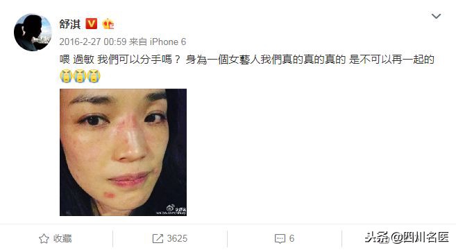 秋冬季补水保湿方法,秋季干性皮肤的补水方法