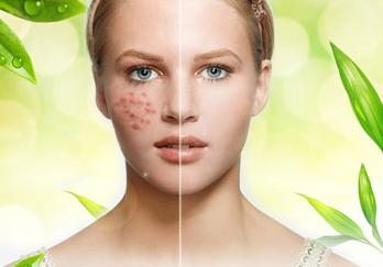 吃什么排毒体内垃圾,女性体内吃什么排毒