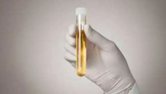 防范尿毒症的方法,远离肾脏病8项黄金法则